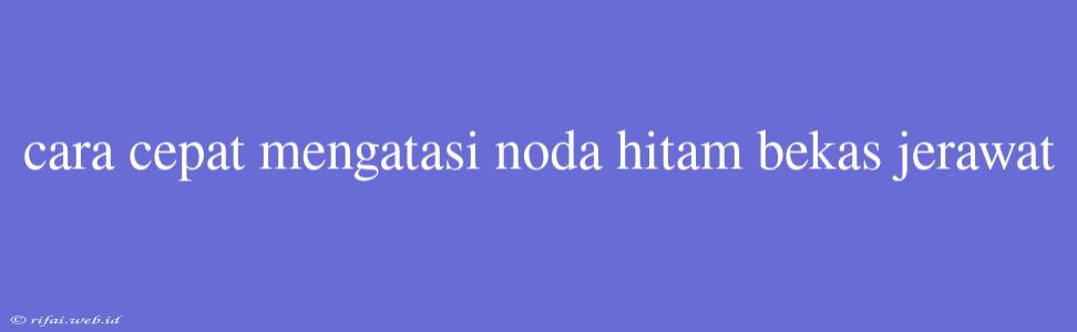 Cara Cepat Mengatasi Noda Hitam Bekas Jerawat