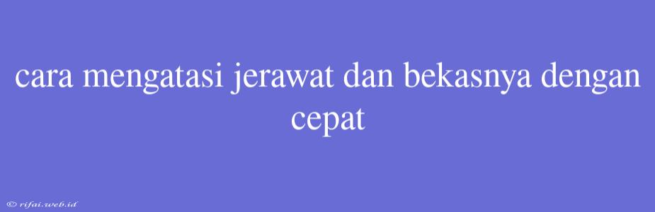 Cara Mengatasi Jerawat Dan Bekasnya Dengan Cepat