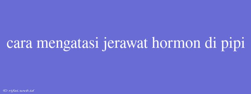 Cara Mengatasi Jerawat Hormon Di Pipi